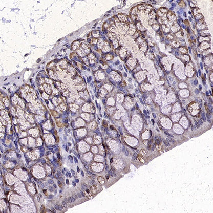 Anterior Gradient 2 Rabbit Polyclonal Antibody