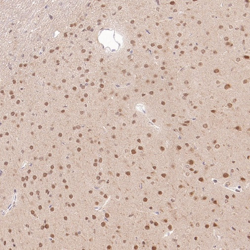 PSMB5 Rabbit Polyclonal Antibody