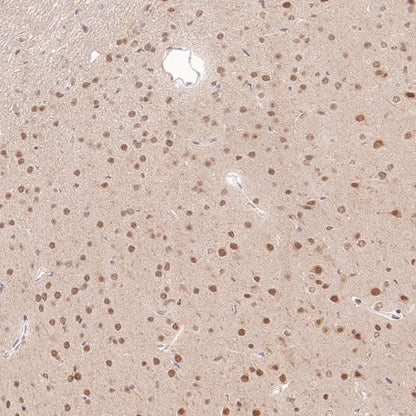 PSMB5 Rabbit Polyclonal Antibody