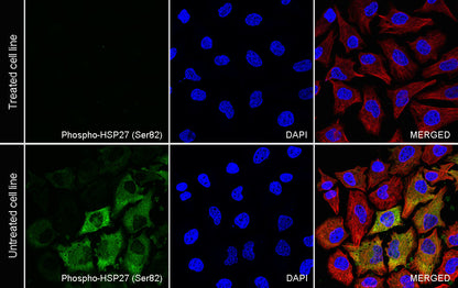Phospho-HSP27 (Ser82) Recombinant Rabbit mAb (S-4792)