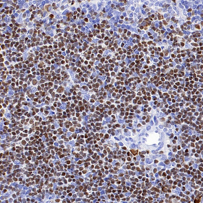 Ctip2 Recombinant Rabbit mAb (S-1375-21)