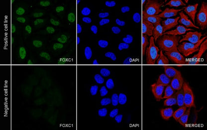 FOXC1 Recombinant Rabbit mAb (S-1607-142)