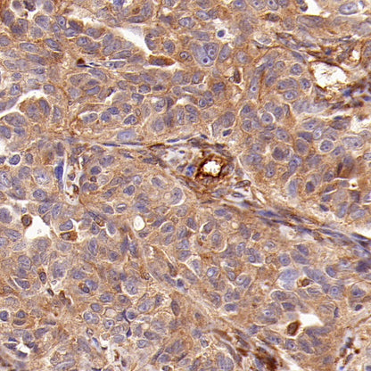 EEA1 Recombinant Rabbit mAb (S-2604-39)