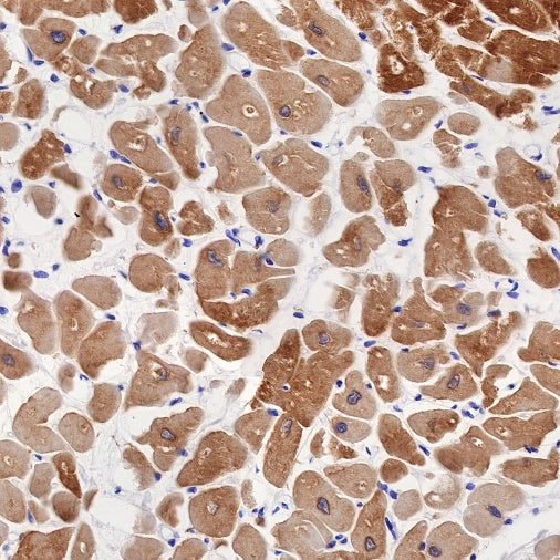 Alpha B Crystallin Recombinant Rabbit mAb (S-R216)