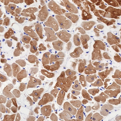 Alpha B Crystallin Recombinant Rabbit mAb (S-R216)