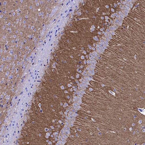 GRM5 Recombinant Rabbit mAb (SDT-2419-37)
