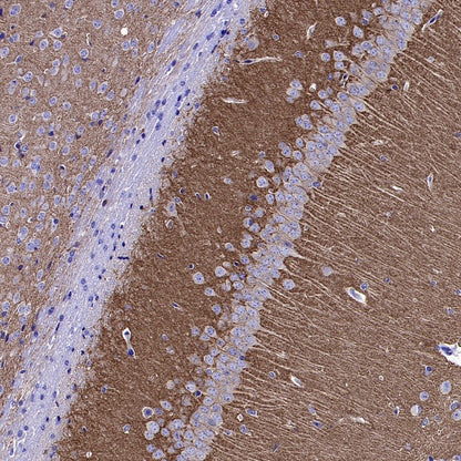 GRM5 Recombinant Rabbit mAb (SDT-2419-37)