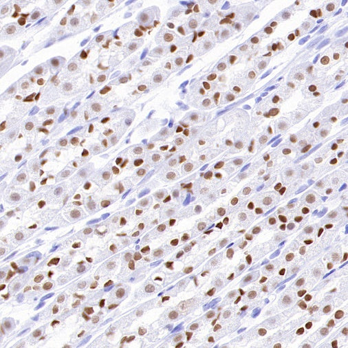 FOXA1 Recombinant Rabbit mAb, PBS Only  (SDT-2779-17)