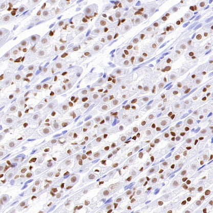 FOXA1 Recombinant Rabbit mAb, PBS Only  (SDT-2779-17)