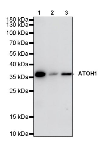 ATOH1 Recombinant Rabbit mAb (S-1301-11)