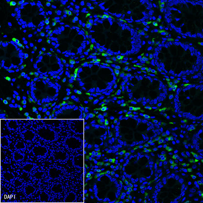 CD79a/MB-1 Recombinant Rabbit mAb (SDT-030-18)