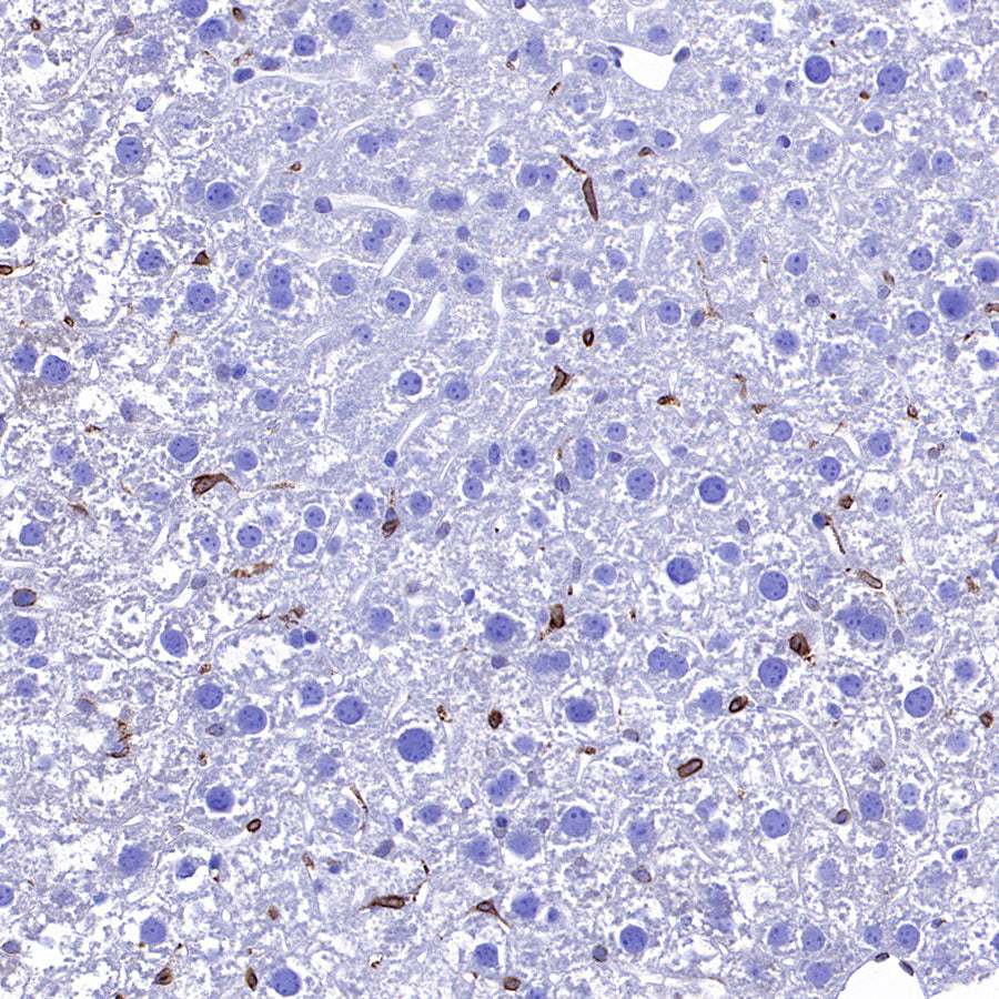 COX2 / Cyclooxygenase Recombinant Rabbit mAb (S-5952)