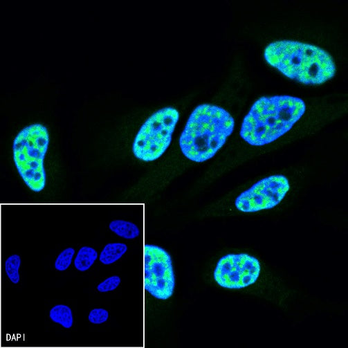 PCNA Recombinant Rabbit mAb (FITC Conjugate) (SDT-297-116)