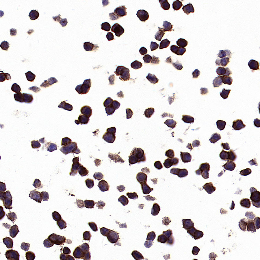 PTK7 Recombinant Rabbit mAb ,PBS Only(SDT-2432-136)