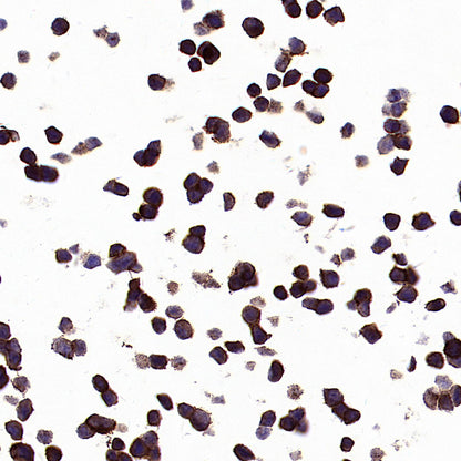 PTK7 Recombinant Rabbit mAb ,PBS Only(SDT-2432-136)