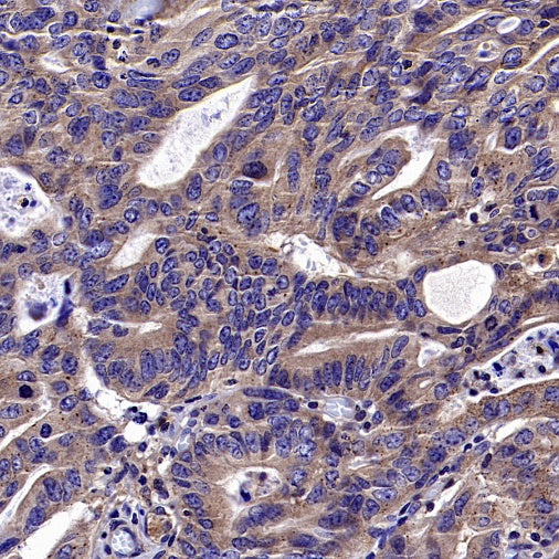 VPS18 Recombinant Rabbit mAb (S-2517-23)