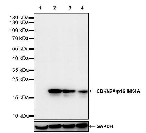 CDKN2A/p16 INK4A Recombinant Mouse mAb (SDT-4677)