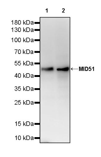 MID51 Recombinant Rabbit mAb (S-3570-28)