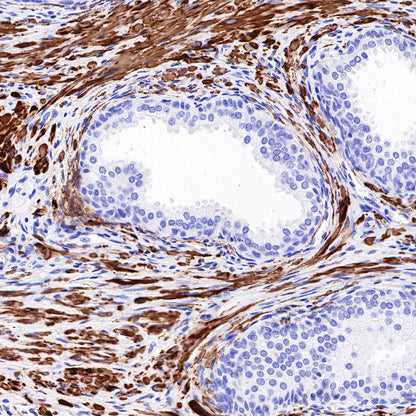 Myosin-11/SMMHC Recombinant Rabbit mAb,PBS Only (SDT-188-112)