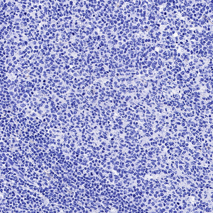 CGB/HCG-β Recombinant Rabbit mAb (SDT-228-46)