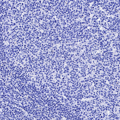 CGB/HCG-β Recombinant Rabbit mAb (SDT-228-46)