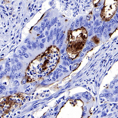 S-RMab® MUC1/EMA Recombinant Rabbit mAb (SDT-776-49)