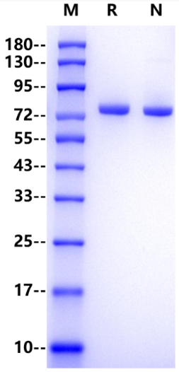 Cadherin-1/CDH1 His Tag Protein, Human