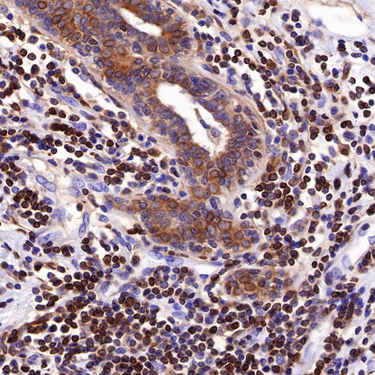 S-RMab® Bcl-2 Recombinant Rabbit mAb,PBS Only (SDT-R160)
