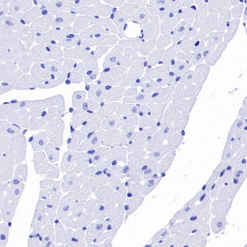 SYT2 Rabbit Polyclonal Antibody