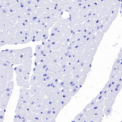 SYT2 Rabbit Polyclonal Antibody