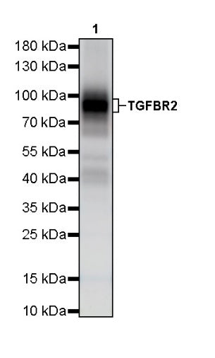 TGFBR2 Recombinant Rabbit mAb (S-1711-55)
