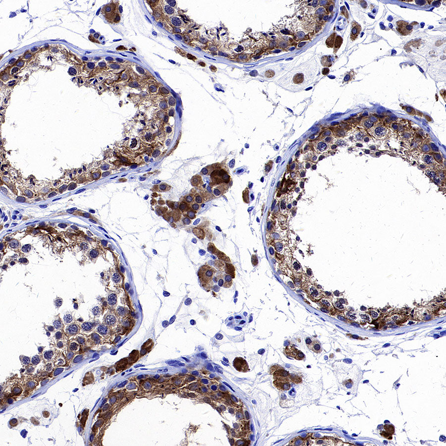 Inhibin alpha Recombinant Rabbit mAb (SDT-3212-24)