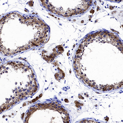 Inhibin alpha Recombinant Rabbit mAb (SDT-3212-24)