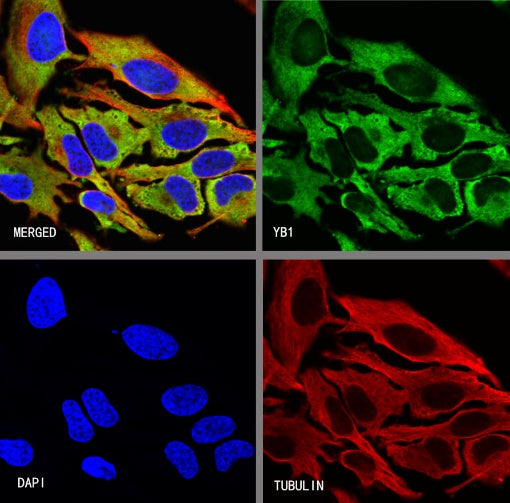 YB1 Recombinant Rabbit mAb (S-1748-144)