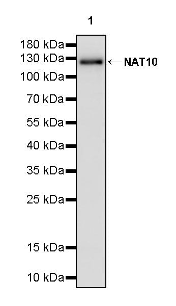 NAT10 Recombinant Rabbit mAb (S-2547-125)