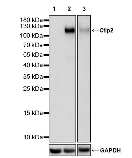 Ctip2 Recombinant Rabbit mAb (S-1375-21)