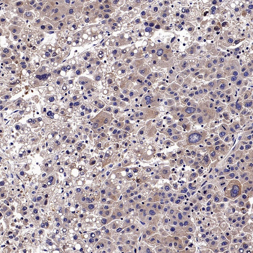 GCLM Recombinant Rabbit mAb (S-2209-19)