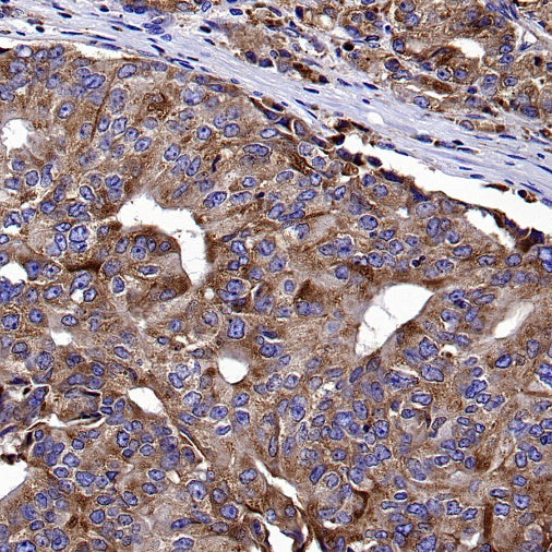 CD107b/LAMP2 Recombinant Mouse mAb (H4B4)