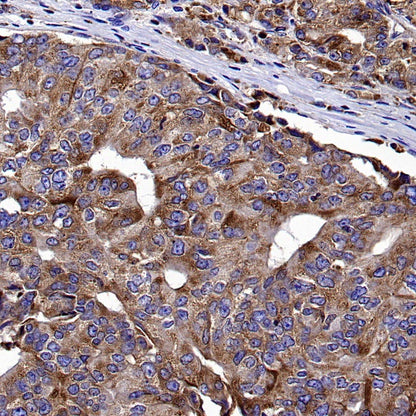 CD107b/LAMP2 Recombinant Mouse mAb (H4B4)