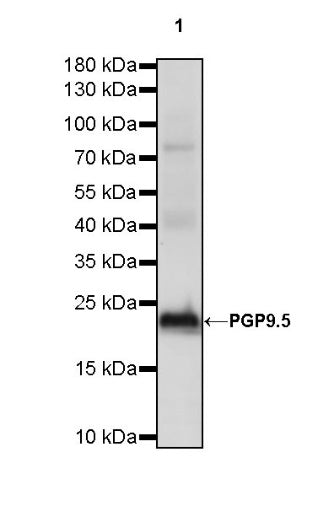 PGP9.5 Recombinant Rabbit mAb (SDT-665-37)