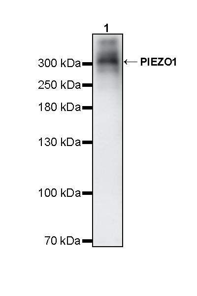PIEZO1 Recombinant Rabbit mAb (S-4008-76)