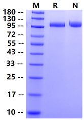 Biotinylated DPP4/CD26 His&Avi Tag Protein, Human