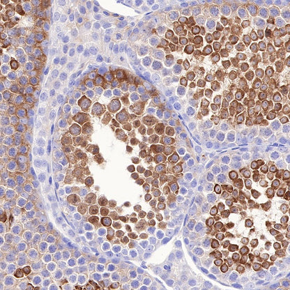 LDH-C/A Recombinant Rabbit mAb (S-R328)
