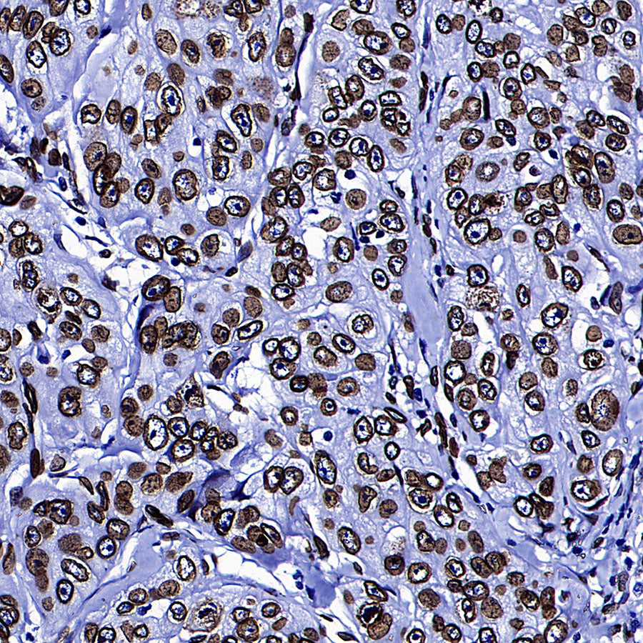 Lamin A/C Recombinant Rabbit mAb (S-5671)