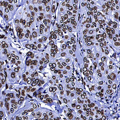 Lamin A/C Recombinant Rabbit mAb (S-5671)