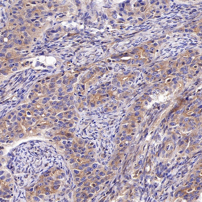 KIF5B+KIF5C Recombinant Rabbit mAb (S-2452-15)