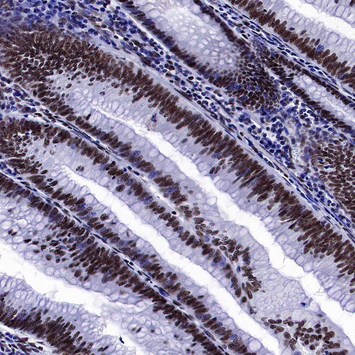 SMARCA2/BRM Recombinant Rabbit mAb (S-1568-17)