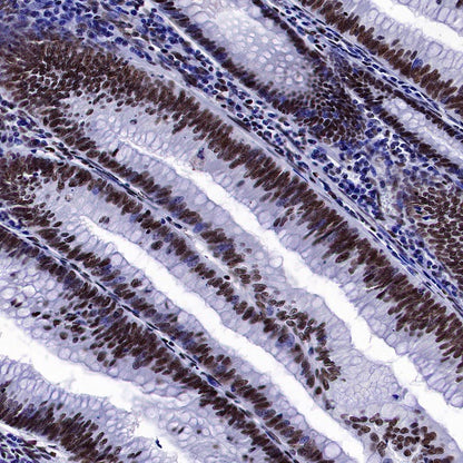 SMARCA2/BRM Recombinant Rabbit mAb (S-1568-17)