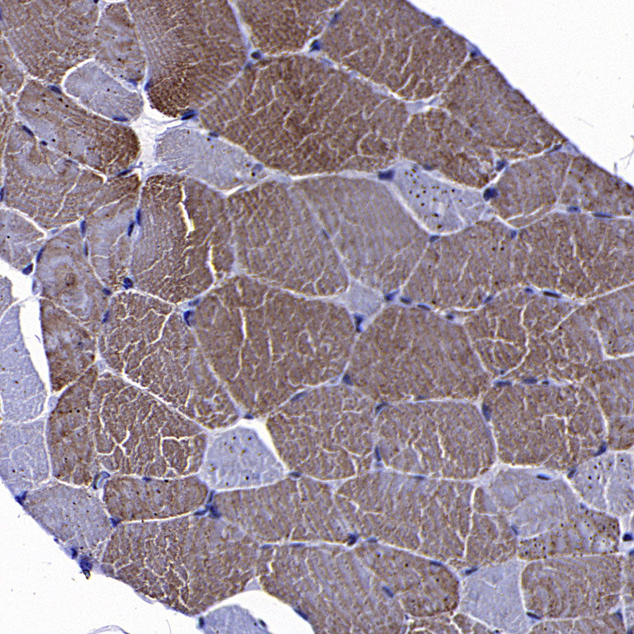 MYH7 Recombinant Rabbit mAb (S-4468-32)