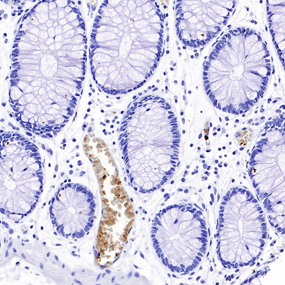 Hemoglobin alpha Recombinant Rabbit mAb (S-R242)
